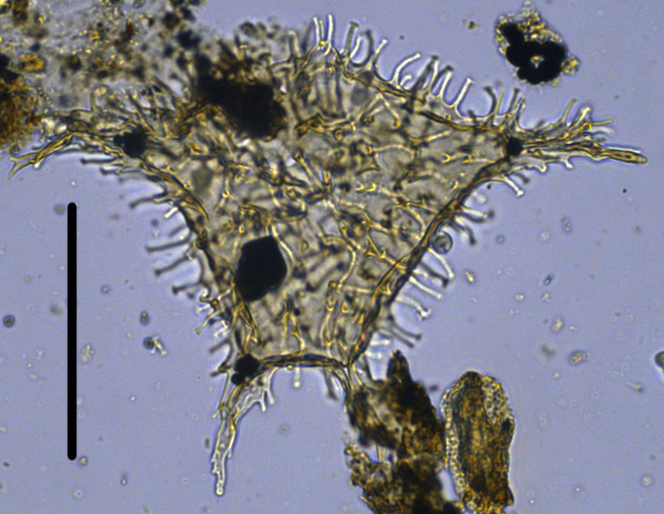 Apectodinium augustum PAau27XCC2861039b.jpg